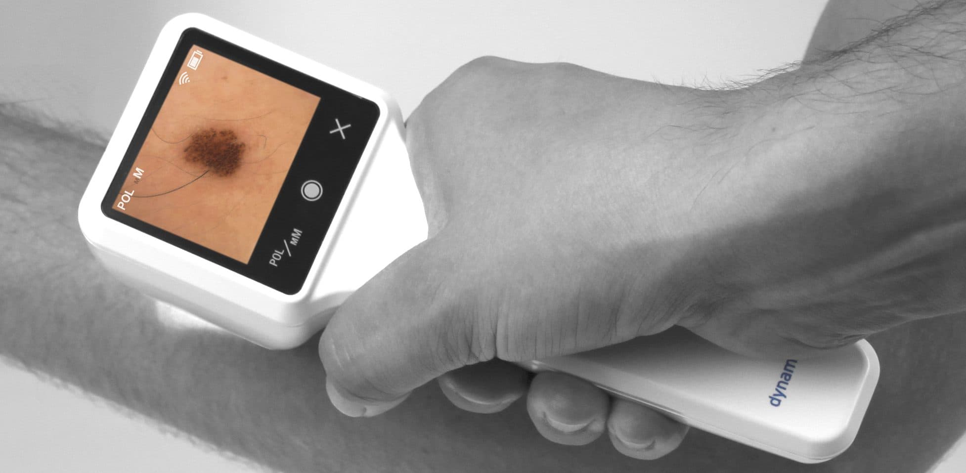 Hautscanner: Dynamify findet Partner