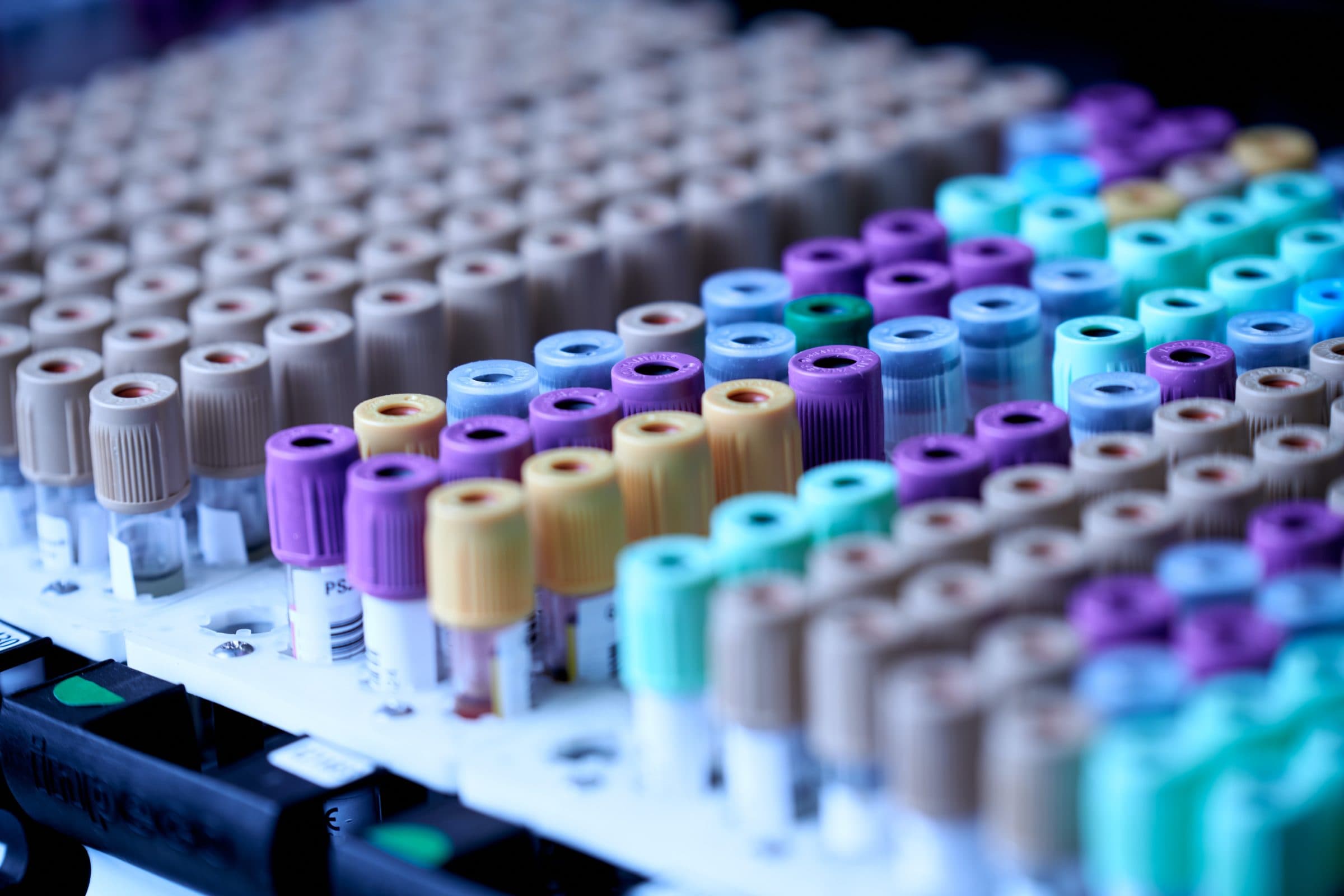 Gentherapie-Startup Vigeneron beginnt Phase I der klinischen Prüfung